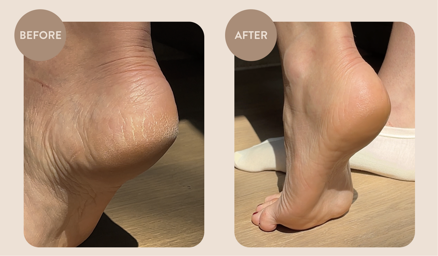 Overnight Foot Rescue Bundle