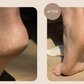 Overnight Foot Rescue Bundle