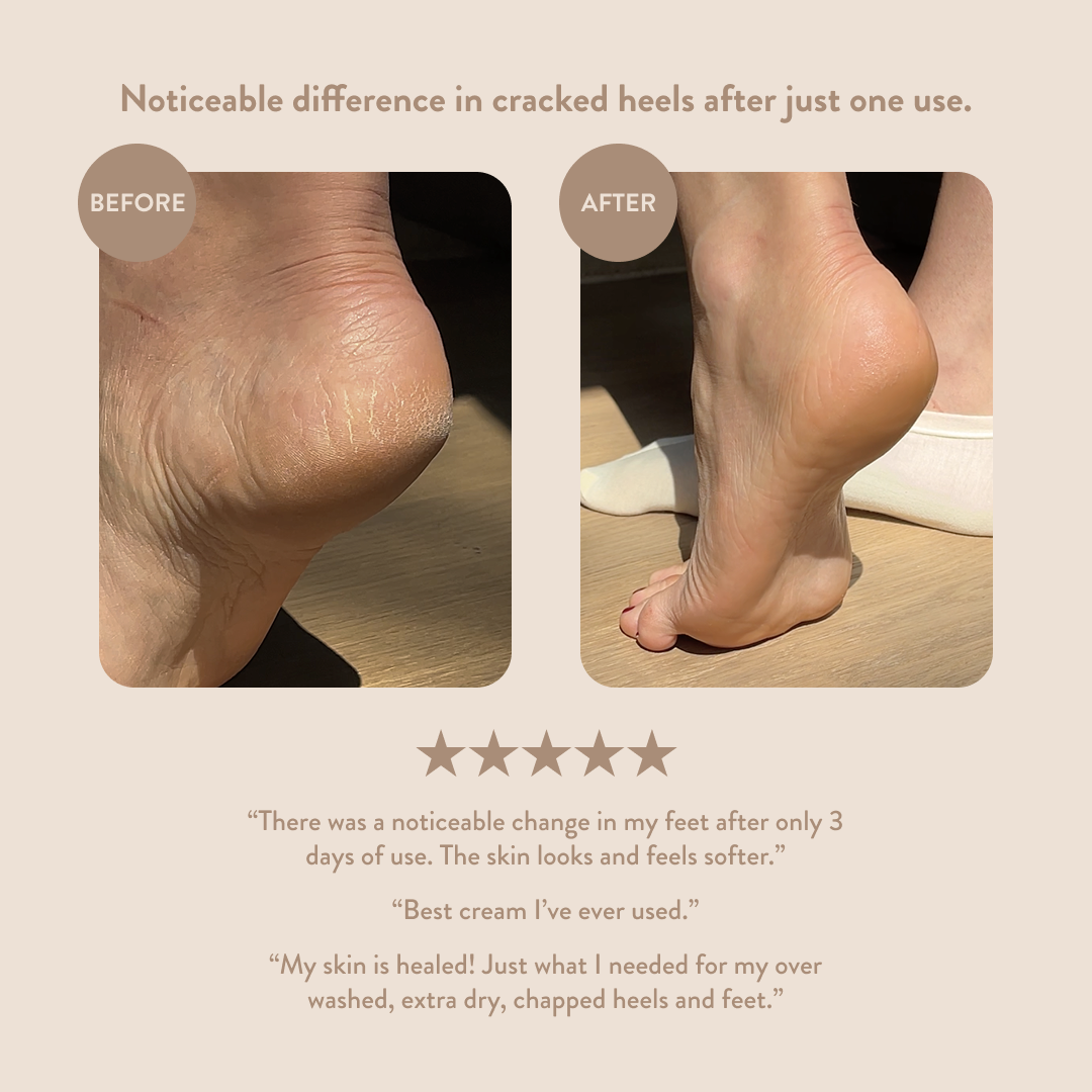 Overnight Hand & Foot Hydration Mask Refill